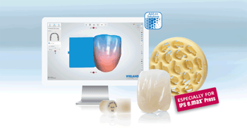 And this is how it works!  First, scan the patient's model situation using a 3Shape dental scanner. All current types of model are suitable for this purpose. Construct the single restorations (veneers, anterior and posterior crowns) as usual.