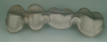 La tecnica di unione per saldatura è una componente irrinunciabile nella routine del laboratorio odontotecnico