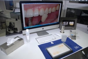 Un tema che sta molto a cuore a Thomas Furter durante la sua attività quotidiana è la definizione del corretto colore dentale. Da tempo esegue questa operazione in modo digitale.