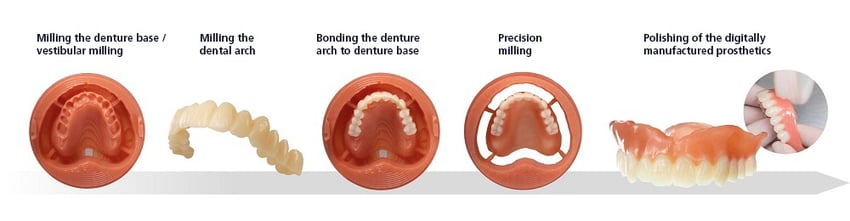 Digital Denture helps users save time compared with conventional denture fabrication methods. They benefit from shorter manufacturing times, fewer manual working steps and fewer interruptions in the workflow than with conventional procedures.