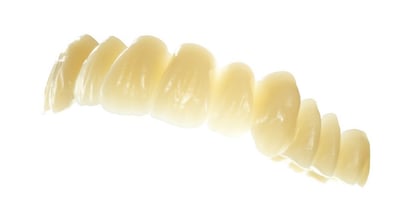 Zahnkranz aus DCL-Material