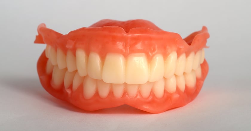 After the CAD/CAM milling process, the interim Digital Denture required only minimal manual finishing.