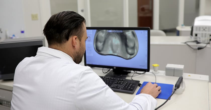 Conception des prothèses dentaires à l'aide du logiciel Digital Denture CAD. Le processus est entièrement automatique. Toutefois, des corrections peuvent être effectuées à chaque étape.