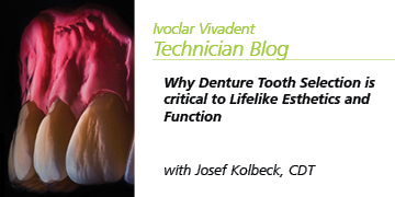 Why Denture Tooth Selection Is Critical to Lifelike Esthetics and Function