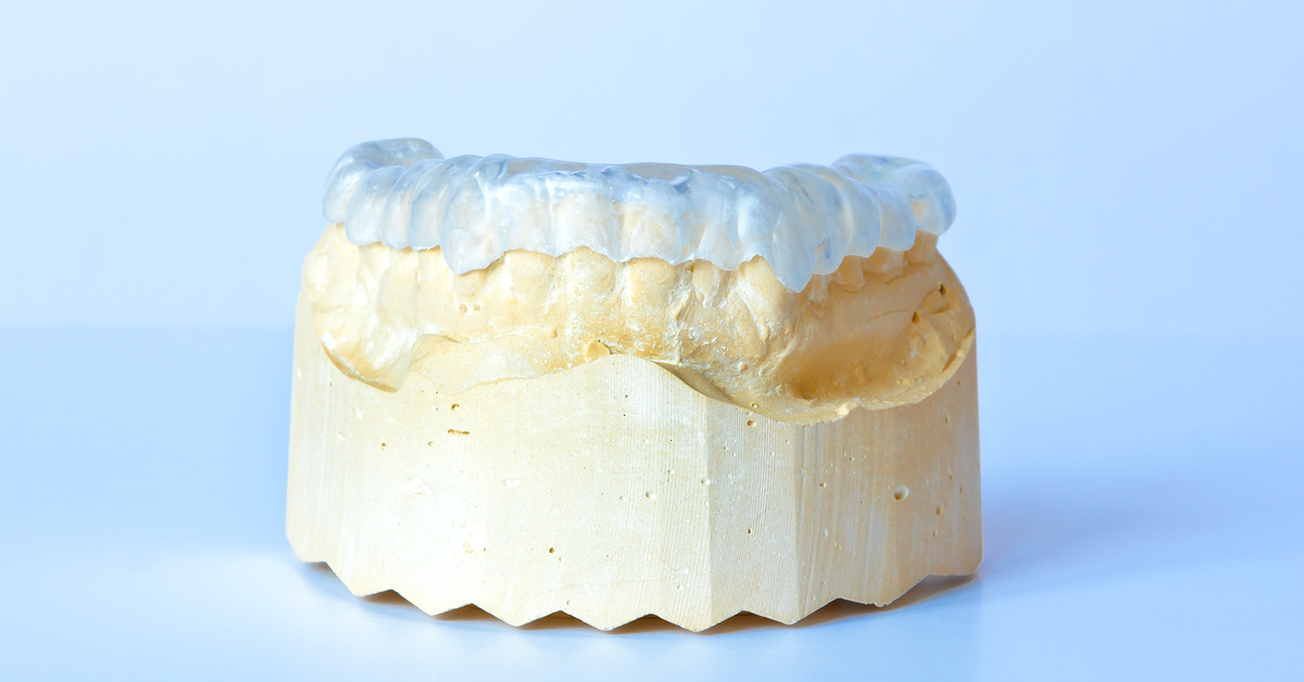 Bruxism: Occlusal splints to prevent bruxism can also be manufactured digitally
