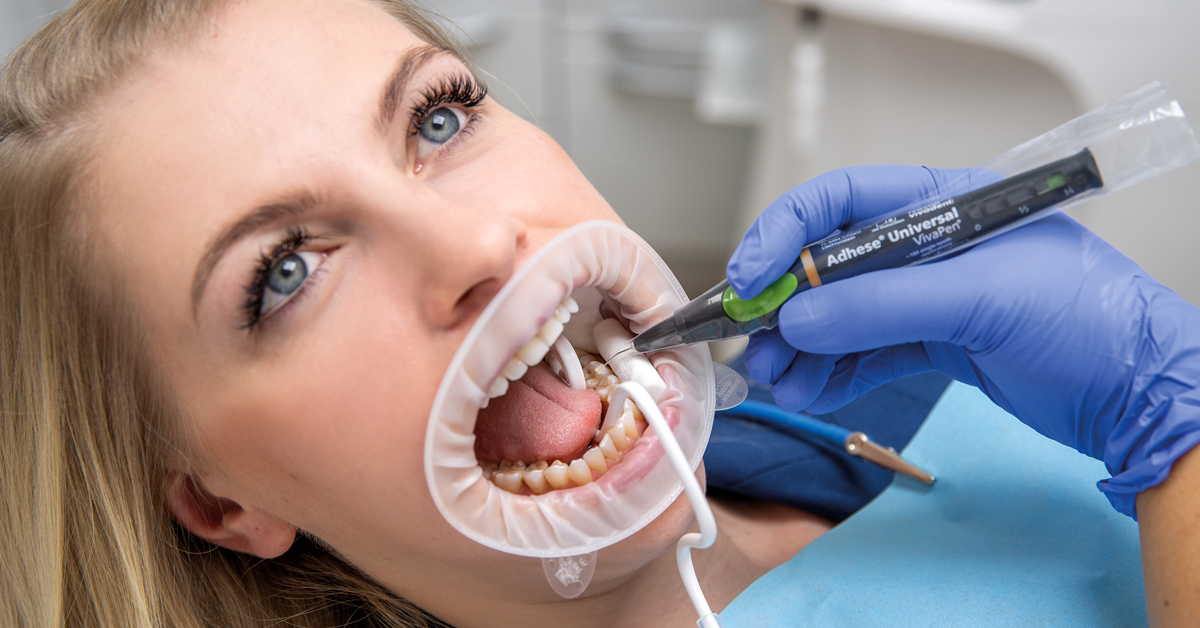 Tip for the dental clinic: adhesive application made easy and efficient