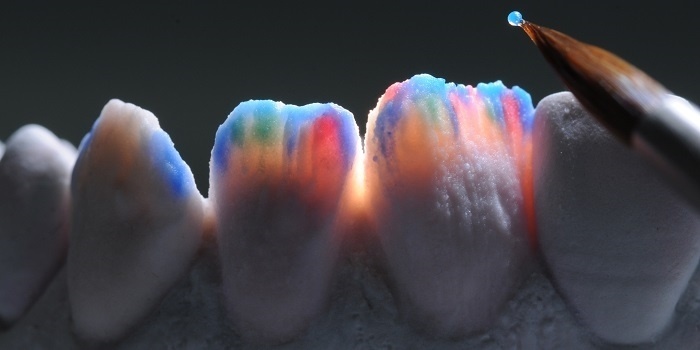 Ceramica dentale: la breve storia di una grande invenzione