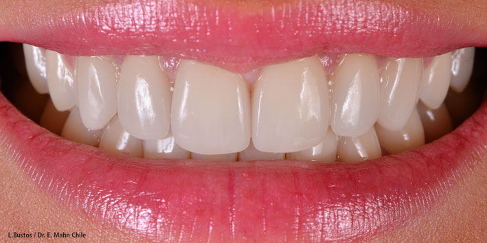 Essential elements for a natural bright smile